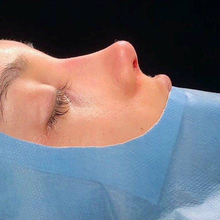 Facial aesthetics
